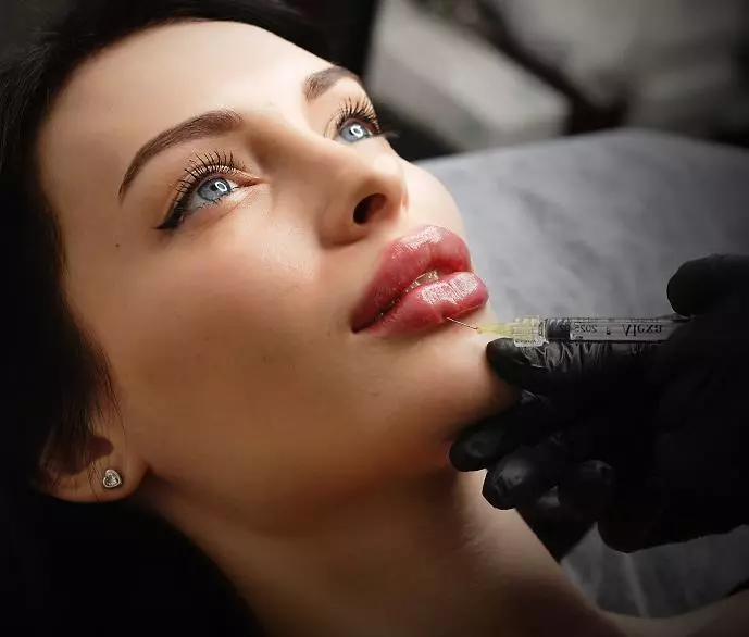 Dermal Fillers Dermal Fillers