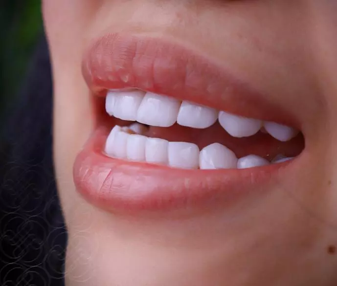 Basic MO Premium Smile Basic MO Premium Smile